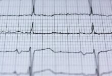 stellar hyper beam technology